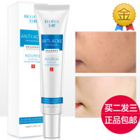 买2送1 清肌去痘美肤膏去痘印痘痘修护凹洞去青春痘产品女男 默认尺寸