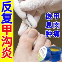 [甲沟有焱膏]甲沟有焱脚趾指甲疼痛嵌甲矫正膏贴长肉芽胀疼膏 严重甲沟炎1瓶(15g)