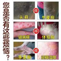 【一抹就消】全身手脚大腿内侧百肤膏抑菌乳膏皮肤外用乳膏 1支装
