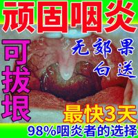 喉咙有痰异物感咽喉爽喷剂蜂胶止扁桃体发炎肿痛嗓子干痒咳嗽神器 [去痰*爽喉咙]咽喉爽1盒