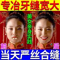 [当天合逢]牙缝宽大修复牙龈萎缩牙齿松动龋齿菌斑牙石牙痛牙膏