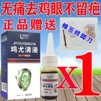鸡眼膏[无痛掉 不用挖]去鸡眼神器鸡尤清液脚底脚趾鸡眼走路疼 一瓶装