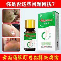 云南鸡眼盯特效抑菌液买二送一,买五送三