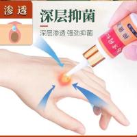 [南京同仁堂]鸡眼膏贴去鸡眼除瘊子老茧肉刺根净去疣灵手指脚底 一瓶鸡眼膏[送6贴鸡眼贴]