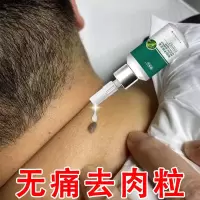 [专攻去疣]去除脖子小肉粒赘皮扁平尤祛疣瘊丝状尤腋下小猴子膏