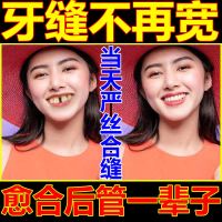 [闭合牙缝]牙缝宽大牙龈萎缩松动吃饭塞牙牙周修护固齿护龈牙膏