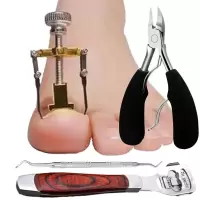 甲沟炎矫正器嵌甲矫正器修脚工具指甲矫正