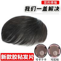 假发男真发头顶补发块 男士假发补发片无痕秃顶短发补发|18*20仿递针头旋毛寸款(可胶粘)