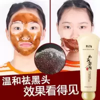 粉刺针夹祛痘挤痘痘美容院去黑头针镊子工具器套装|轻松祛粉刺面膜