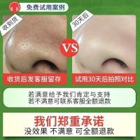 [黑头效果好]竹炭去黑头面膜撕拉收缩清洁毛孔神器粉刺男女学生