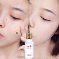 去痣点痣水无痕黑痣祛痣斑水祛痣膏修复防疤神器脸部祛斑精油