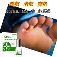 无痛去除鸡茧专用液跖疣瘊子老茧脚垫鸡眼抑菌液特效液 一瓶装
