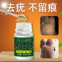 去除肉刺刺瘊子去除跖疣寻常疣去除猴子瘊子鸡眼脖子肉粒手脚趾疣