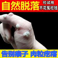 去除脖子小肉粒颈部赘皮赘草温和不留疤祛丝状尤腋下小猴子刺猴肉 1瓶装[体验效果不明显]