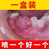 牙痛宁喷剂牙疼喷剂特效立可停蛀牙虫牙牙洞牙龈肿痛神经快速止痛 一盒装(无)