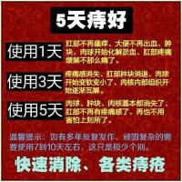 痔疮膏消肉球痔痔膏成人男女内外混合栓草本痣疮膏痔疮膏庤膏