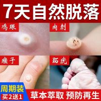 南京同仁堂鸡眼贴鸡眼膏去除瘊子足部脚底脚趾手部根肉刺去疣灵 [药店同款]发1盒(体验装)