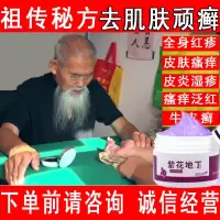 紫花地丁透皮抑菌膏治牛皮癣皮炎湿疹荨麻疹疥疮皮肤瘙痒特效