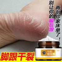 [脚后跟干裂专用]脚跟严重干裂脱皮粗糙皲裂起皮涂抹滋养修复膏 1瓶装 轻微粗糙使用
