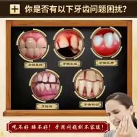 修正牙齿松动牙龈萎缩修复出血肿痛固齿散防蛀牙修复牙洞喷剂