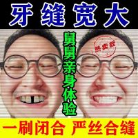 【修复牙缝】牙龈出血萎缩修复牙齿松动牙缝宽抗敏感固齿护龈牙膏