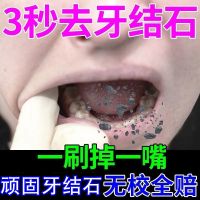 [10倍功效不白退全款]去除顽固牙结石牙膏牙结石一刷光去渍烟渍 一支去口臭美白