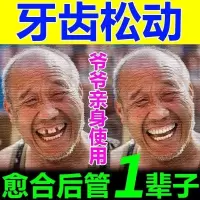 [专冶牙齿宽]牙缝宽吃饭塞牙龈萎缩出血牙齿松动修复牙膏