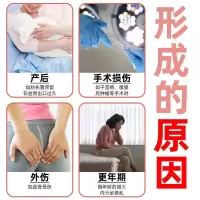 女性遗尿漏尿贴尿频咳嗽打喷嚏大笑用力引起小尿便失禁妇女漏尿贴