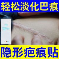 【七日消疤】伤疤贴祛疤贴烫伤淡化疤痕人工皮剖腹产手术伤贴 特级冷敷疤痕贴 不好全退 实发1贴【基础装】 不划算