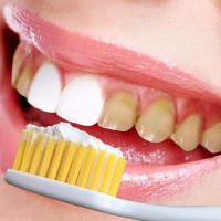 云南本草牙齿洗白洁牙去黄牙牙渍烟渍牙垢牙结石洗牙粉牙斑净_单瓶