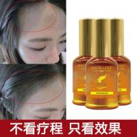 30ml 草本 [促销价]育发液防脱发产品防脱育发精华液密发育发液