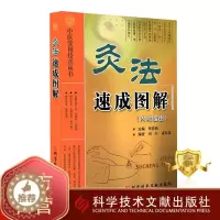 [醉染正版]正版 灸法速成图解 中医实用技术丛书 灸法疗法 中医医学养生保健书籍 科学技术文献出版社