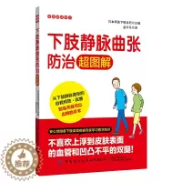 [醉染正版]下肢静脉曲张防治超图解 家庭健康常识观念养生宝典饮食营养与健康医学常识急救知识书籍养生书籍专业知识健康管理自