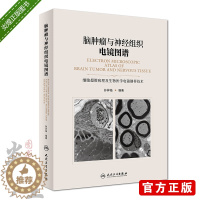 [醉染正版]脑肿瘤与神经组织电镜图谱 孙异临编著 人民卫生出版社9787117269025