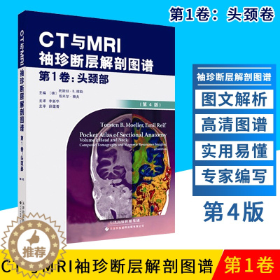[醉染正版]CT与MRI袖珍断层解剖图谱 头颈部 头颈部影像诊断学 头影测量 ct读片 医学影像 ct诊断与临床 天津科