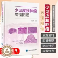 [醉染正版]正版 少见皮肤肿瘤病理图谱 常建民 北京大学医学出版社 适合皮肤科医师以及病理科医师参考使用 佩吉特样鲍恩病