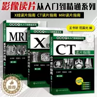 [醉染正版]影像读片从入门到精通系列(第二版)CT读片指南+MRI读片指南+X线读片指南套装3册医学超声影像诊断 学诊断