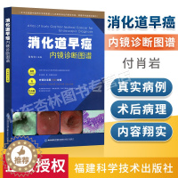 [醉染正版]正版 消化道早癌内镜诊断图谱付肖岩 消化道癌症早期内镜观察鉴别诊断治疗临床医学书籍消化道疾病内镜检查安全操作