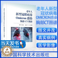 [醉染正版]全新老年人新型OMICRON感染胸部CT图谱卢洁,李宏军9787523602805中国科学技术出版社医学