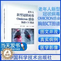 [醉染正版]全新老年人新型OMICRON感染胸部CT图谱卢洁,李宏军9787523602805中国科学技术出版社医学