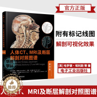 [醉染正版]人体CT、MRI及断层解剖对照图谱(第四版)第4版放射科医生放射技师外科医生培训临床实践临床医学人体解剖学