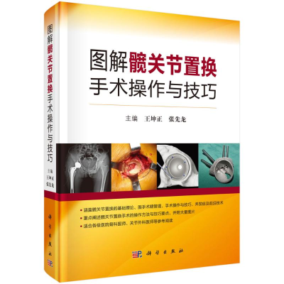 醉染图书图解髋关节置换手术操作与技巧(精)9787030656667