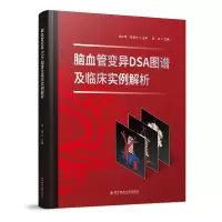醉染图书脑血管变异DSA图谱及临床实例解析9787518995318