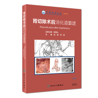 醉染图书胃切除术后消化道重建9787117279079