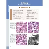 醉染图书移植诊断病理学 原书第2版9787504690555