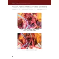 醉染图书胰腺疾病基础与临床 原书第3版 典藏版9787504683113