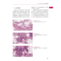 醉染图书乳腺病理学9787504689986