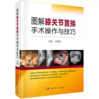 醉染图书图解膝关节置换手术操作与技巧9787030616418