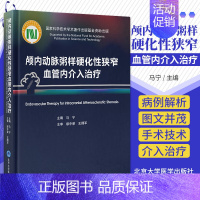 [正版]颅内动脉粥样硬化性狭窄血管内介入治疗 马宁 中英双语对照ICAS研究血管内治疗技术临床精选病例 北京大学医学出版