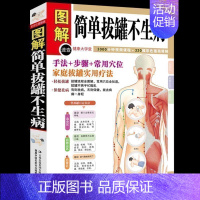 [正版] 简单拔罐不生病 图解彩绘版中医保健养生书籍 家庭保健书拔罐教学拔罐手法步奏 穴位教学家庭拔罐实用疗法保健养生书